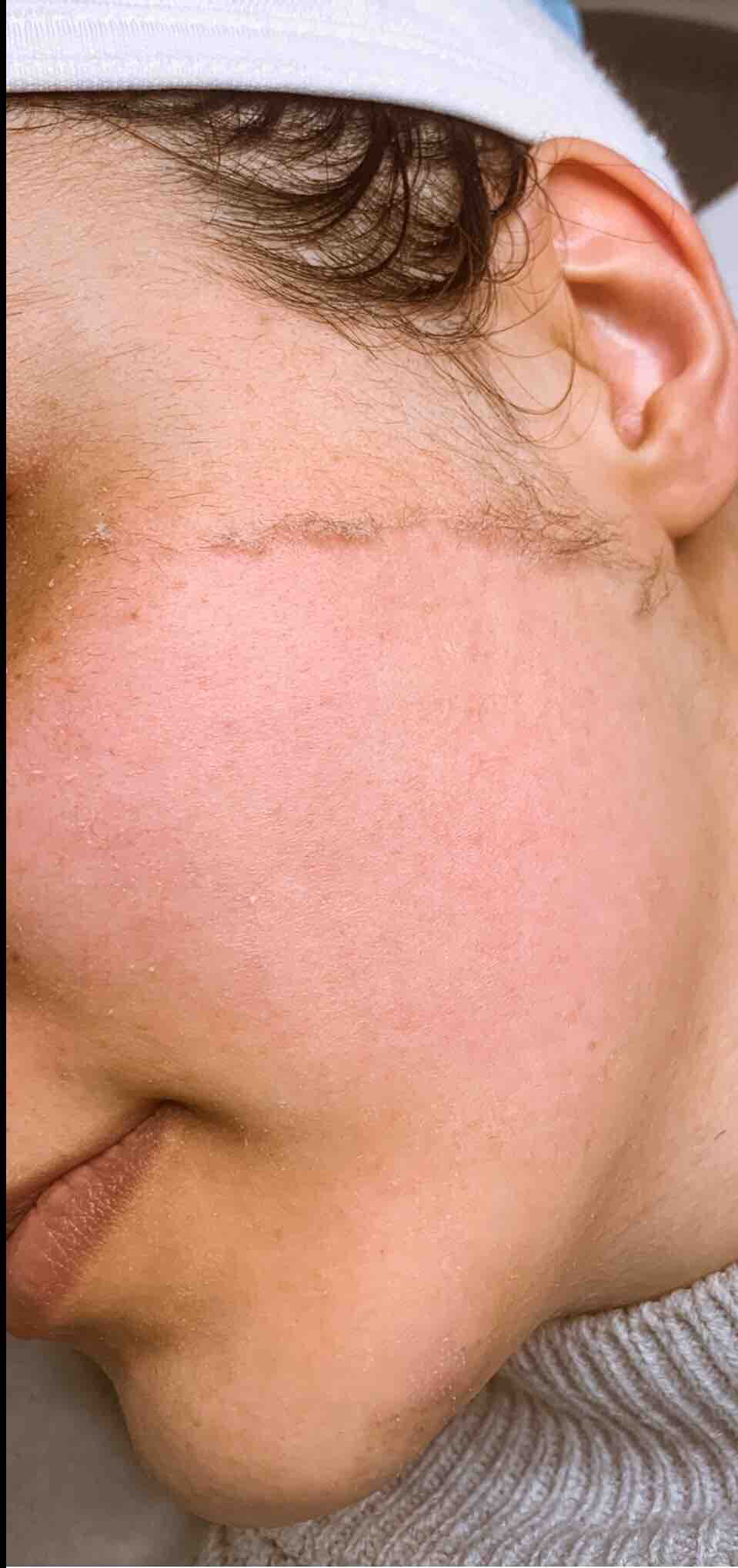 DERMAPLANING TREATMENT + MASK
