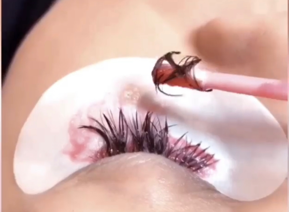 Eyelash Removal