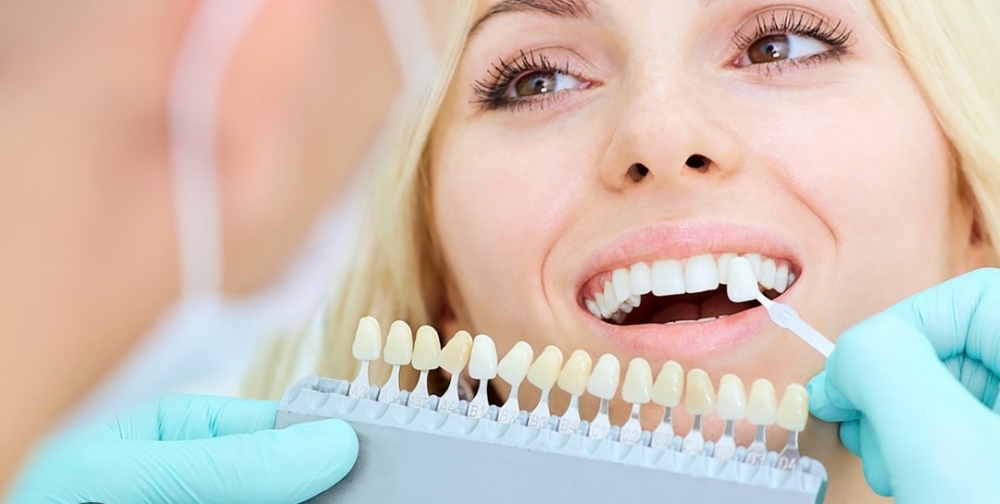 Teeth Whitening (2) Sessions