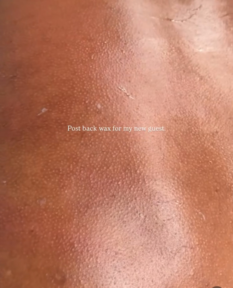 Back Wax at J Esthetics in Homewood, IL