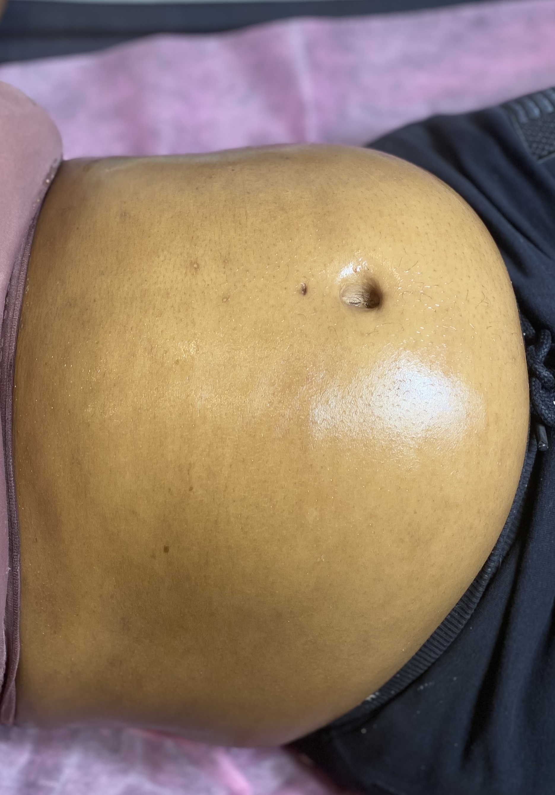 Belly Bump Facial