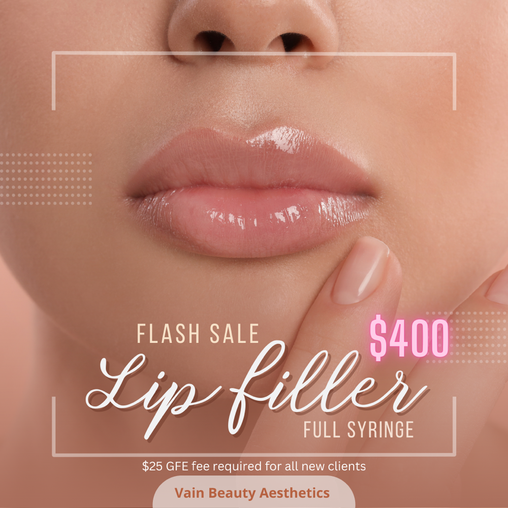 $100 Off Lip Filler Special