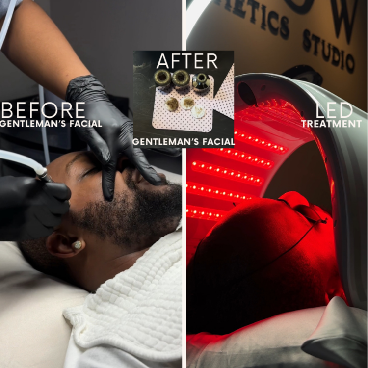 Gentleman’s Facial at Glow Aesthetics Studio in Atlanta, GA