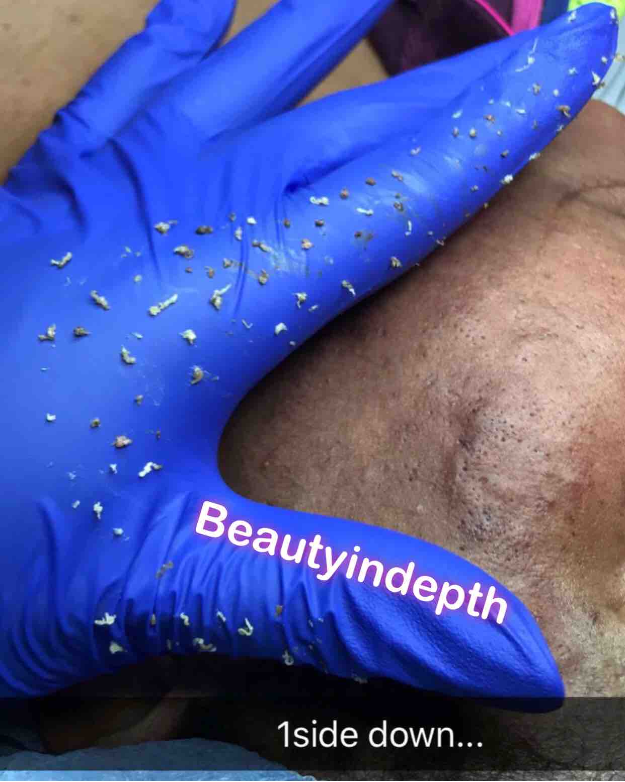 Diamond In The Rough Facial