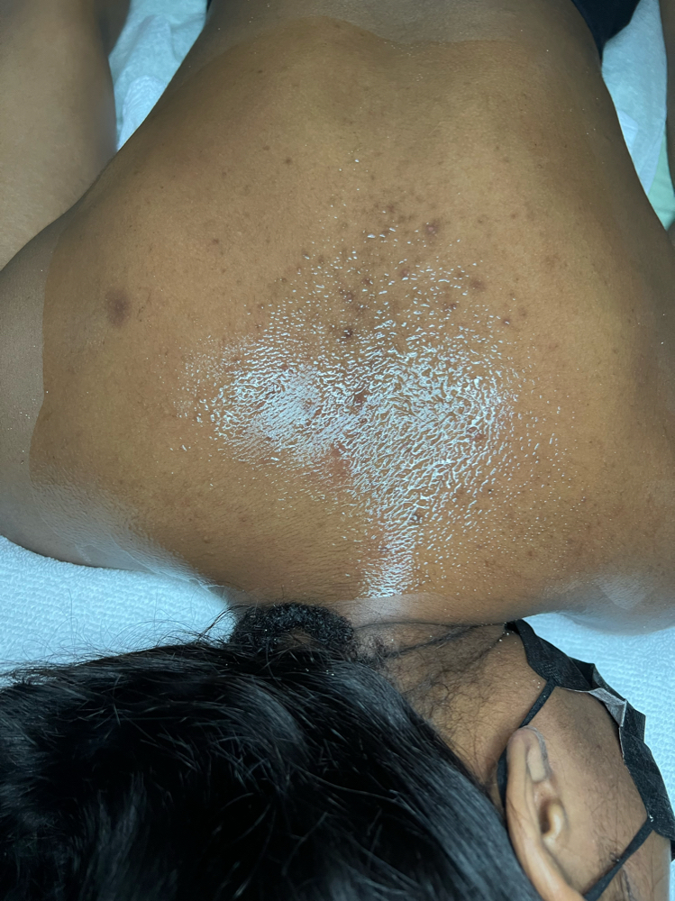 Bringing Sexy Back (Back Treatment)