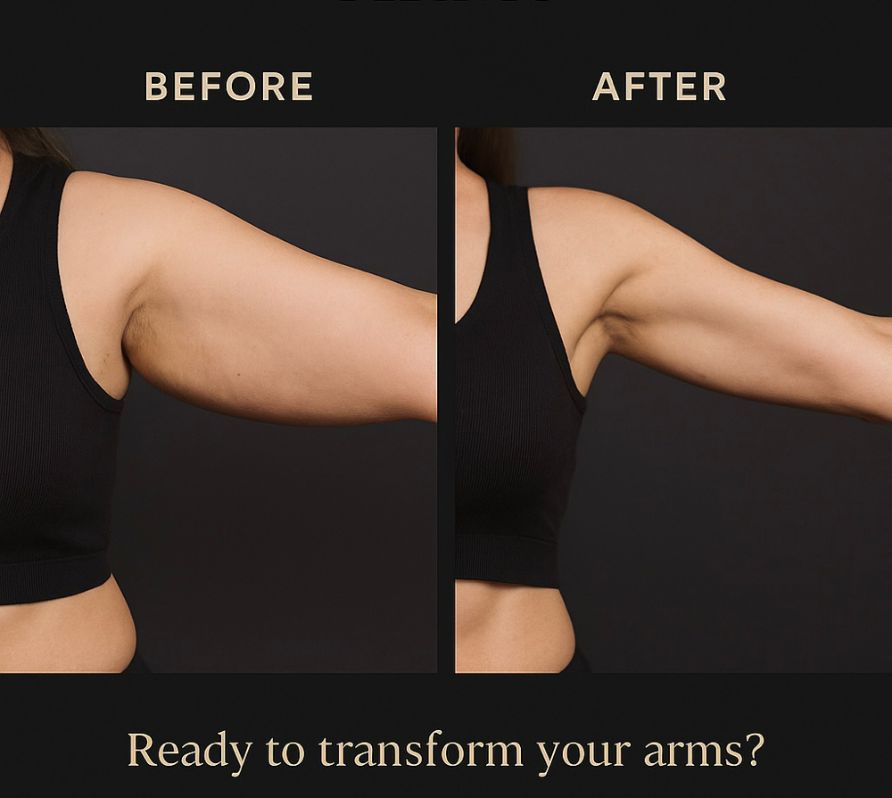 Arm Sculpting