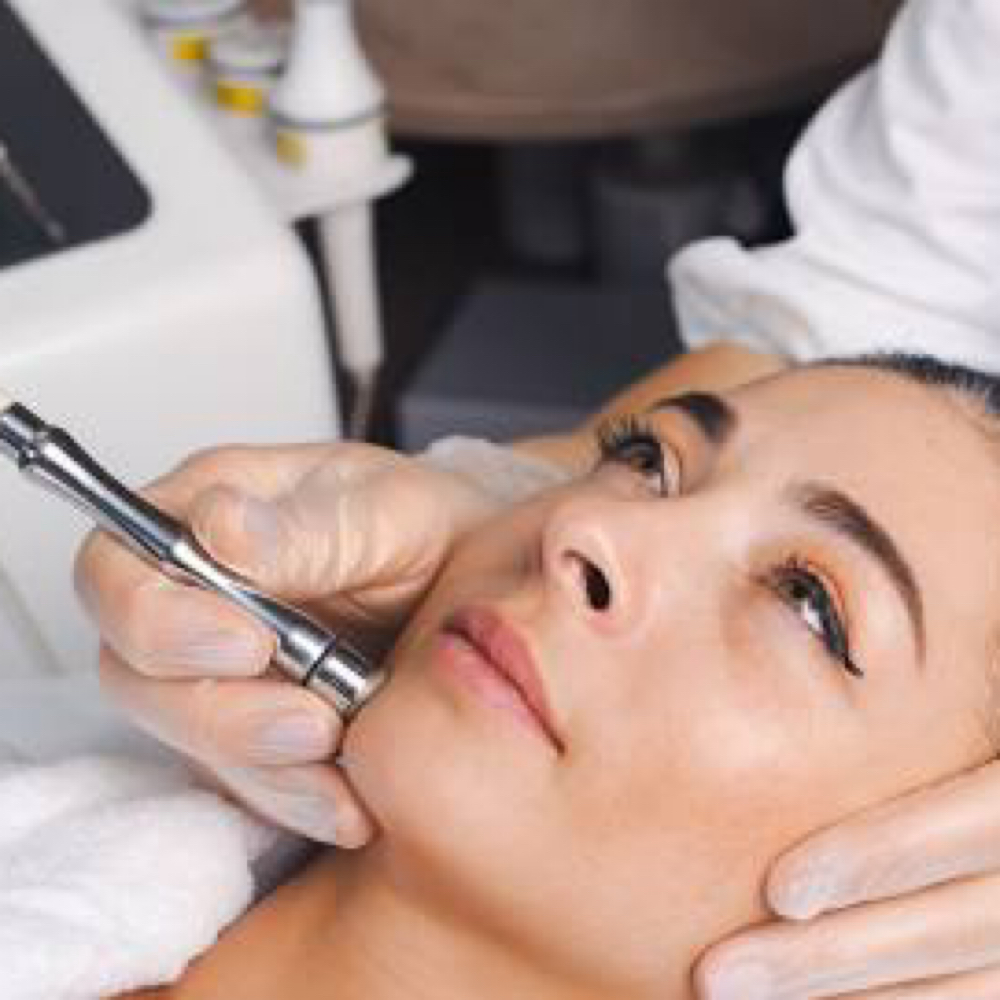 Microdermabrasion Facial at WaxLand & BodySculpting in Los Angeles, CA