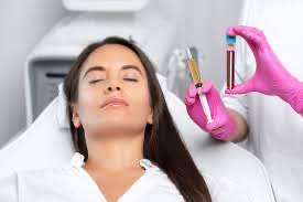 Vampire Facial  Microneedling PRP