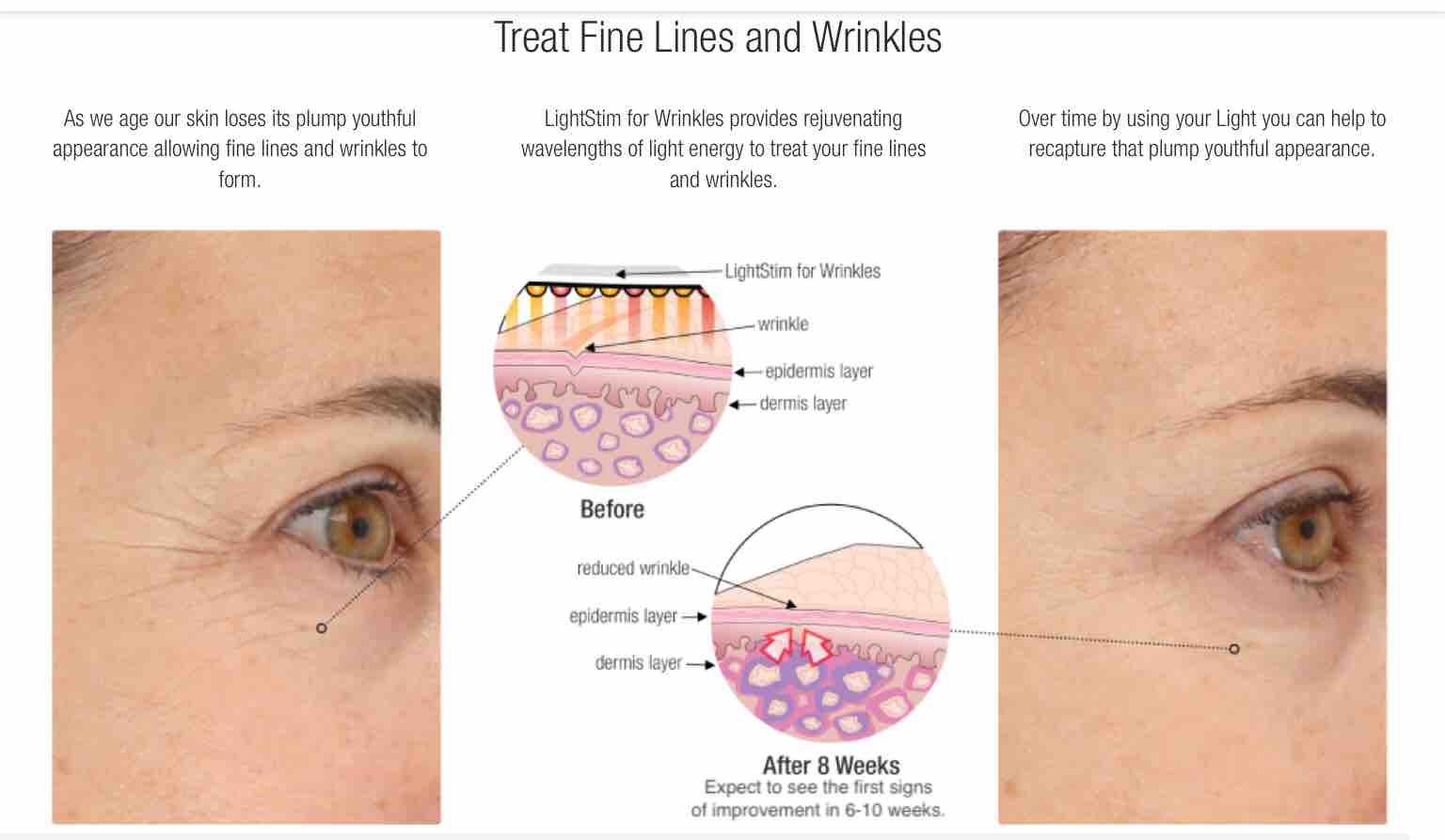 LightStim LED Anti-Aging