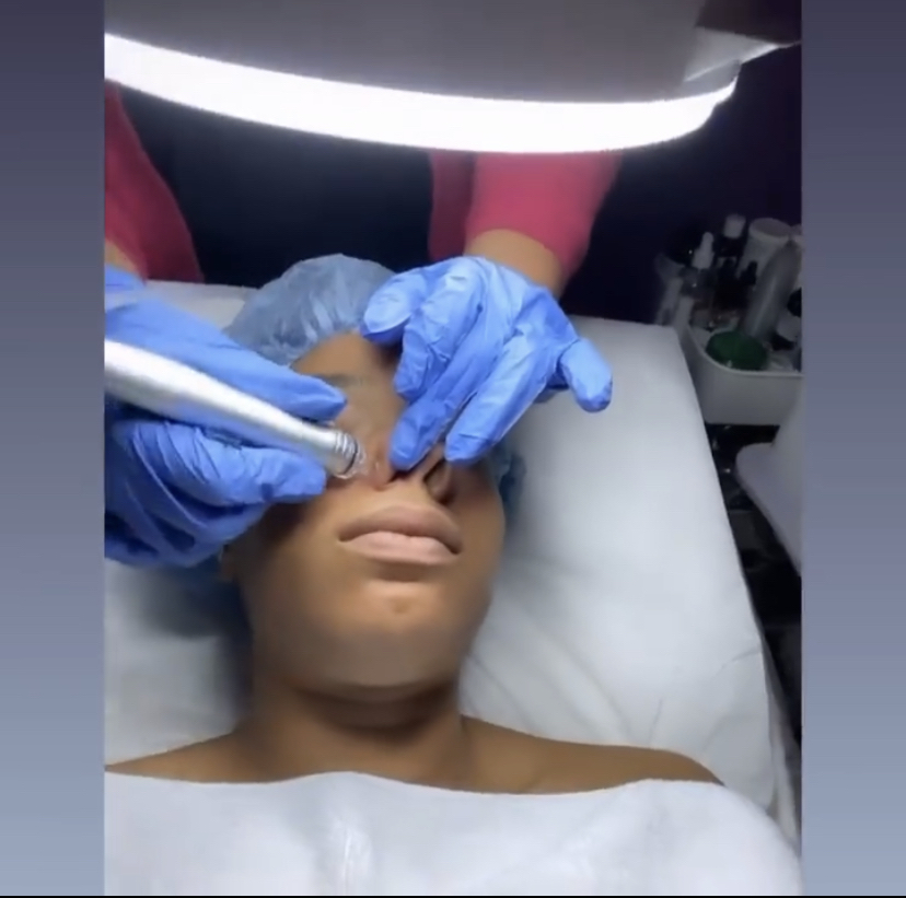 Dermeluxx Facial