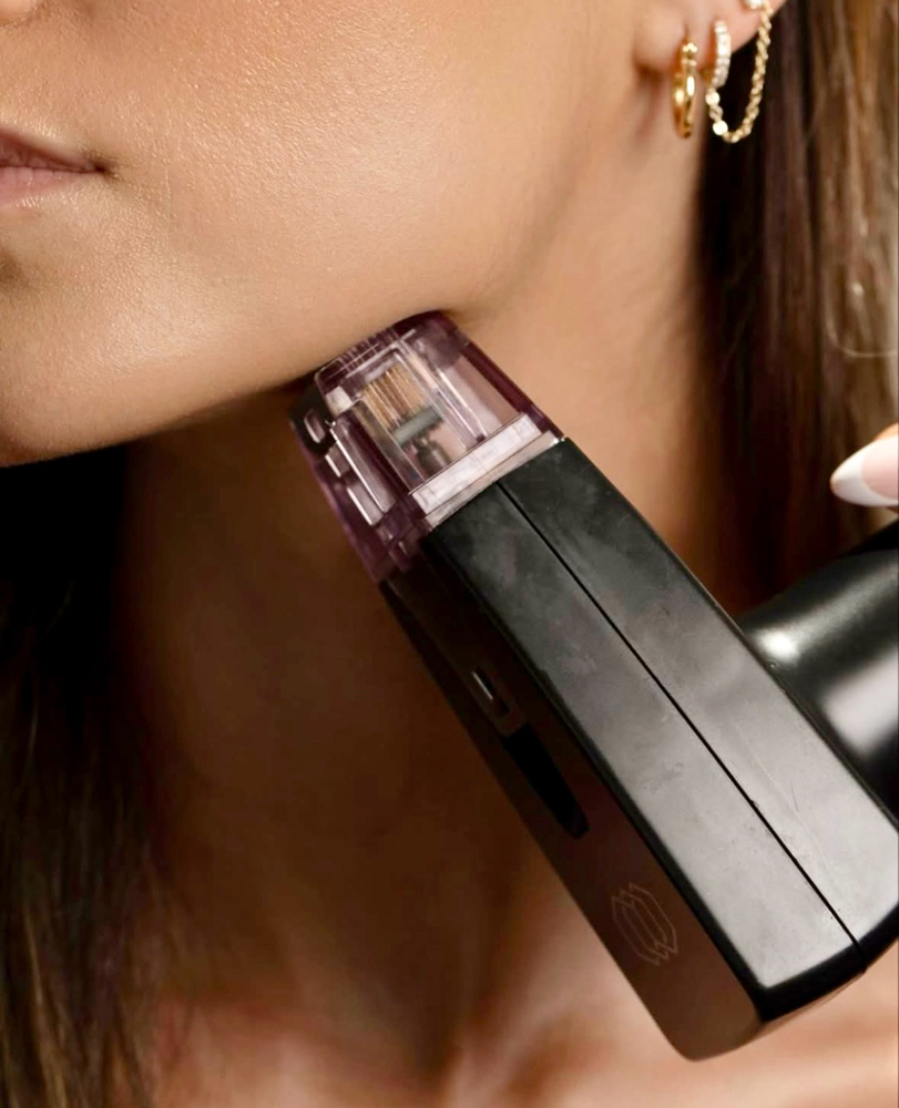 MORPHEUS8 SKIN REJUVENATION