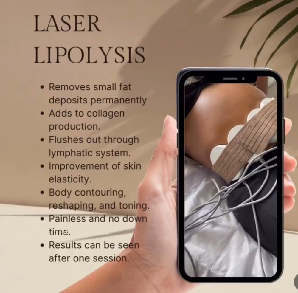 Laser Lipolysis