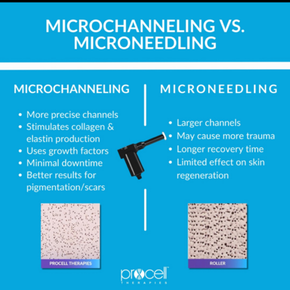 Microchannel Packages Treatment 6 at BLOOM Holistic Skincare in White Bear Lake, MN