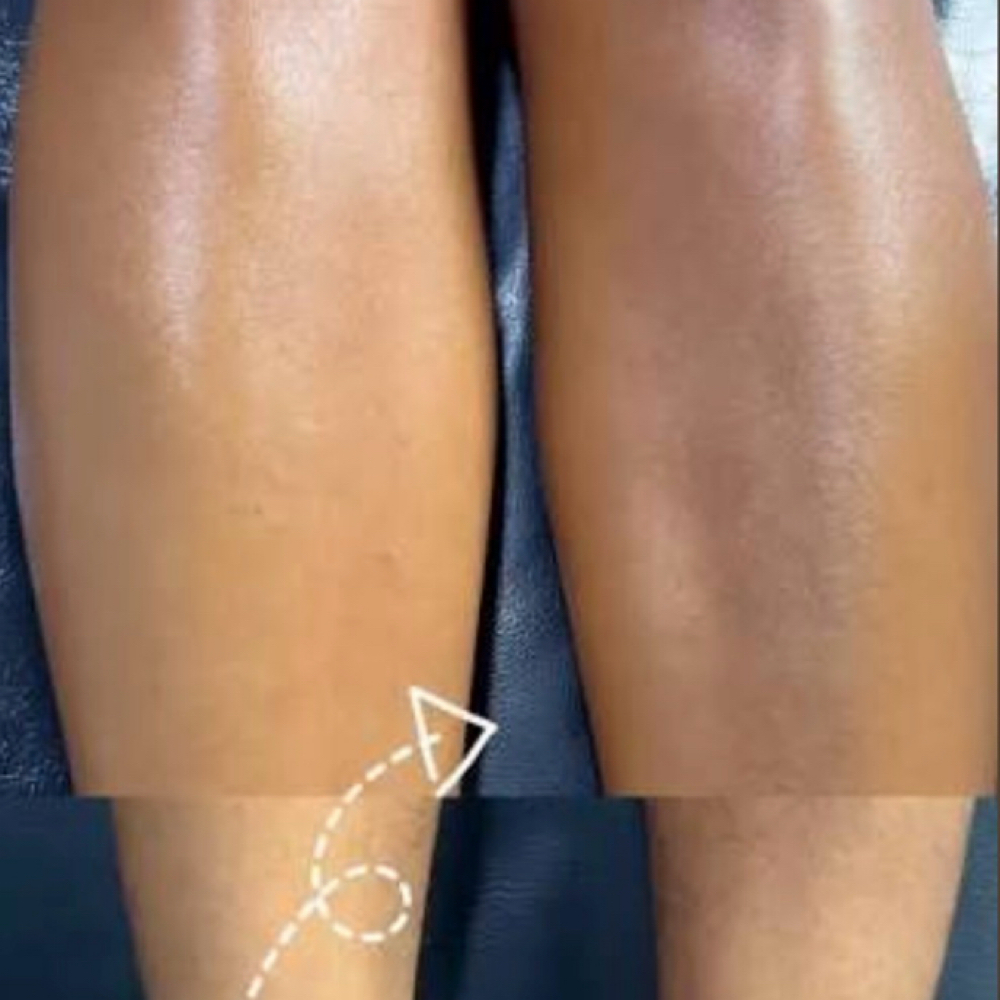 Full Leg Wax at Goddess Glow Esthetics in Houston, TX