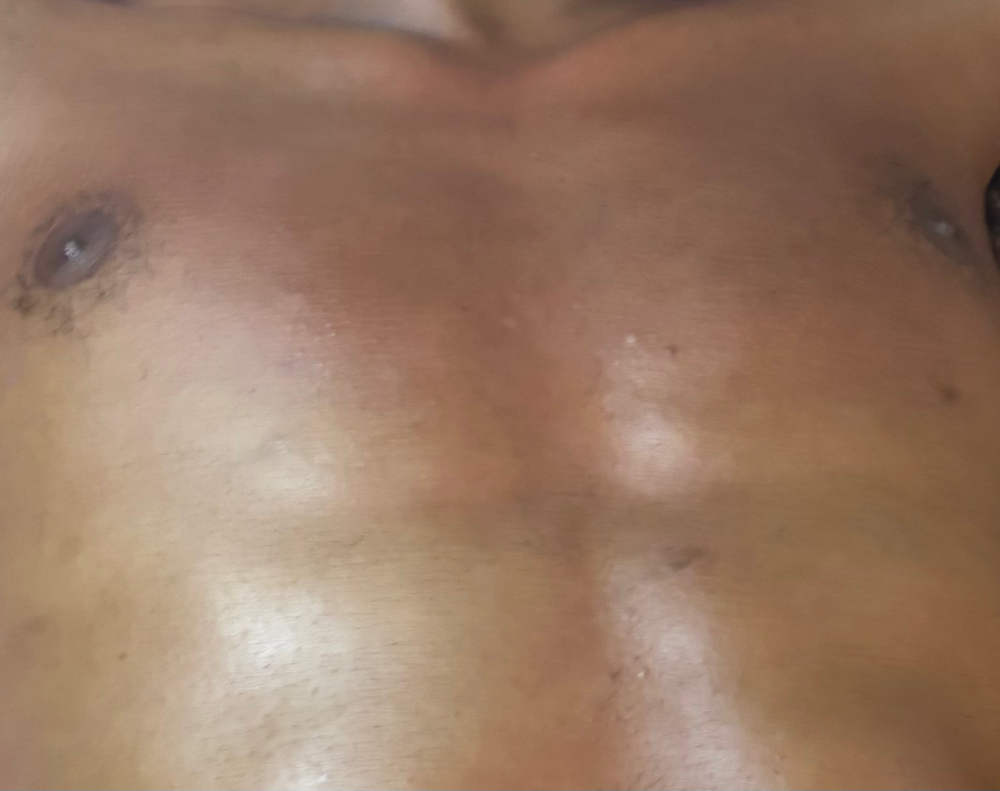 Chest Wax