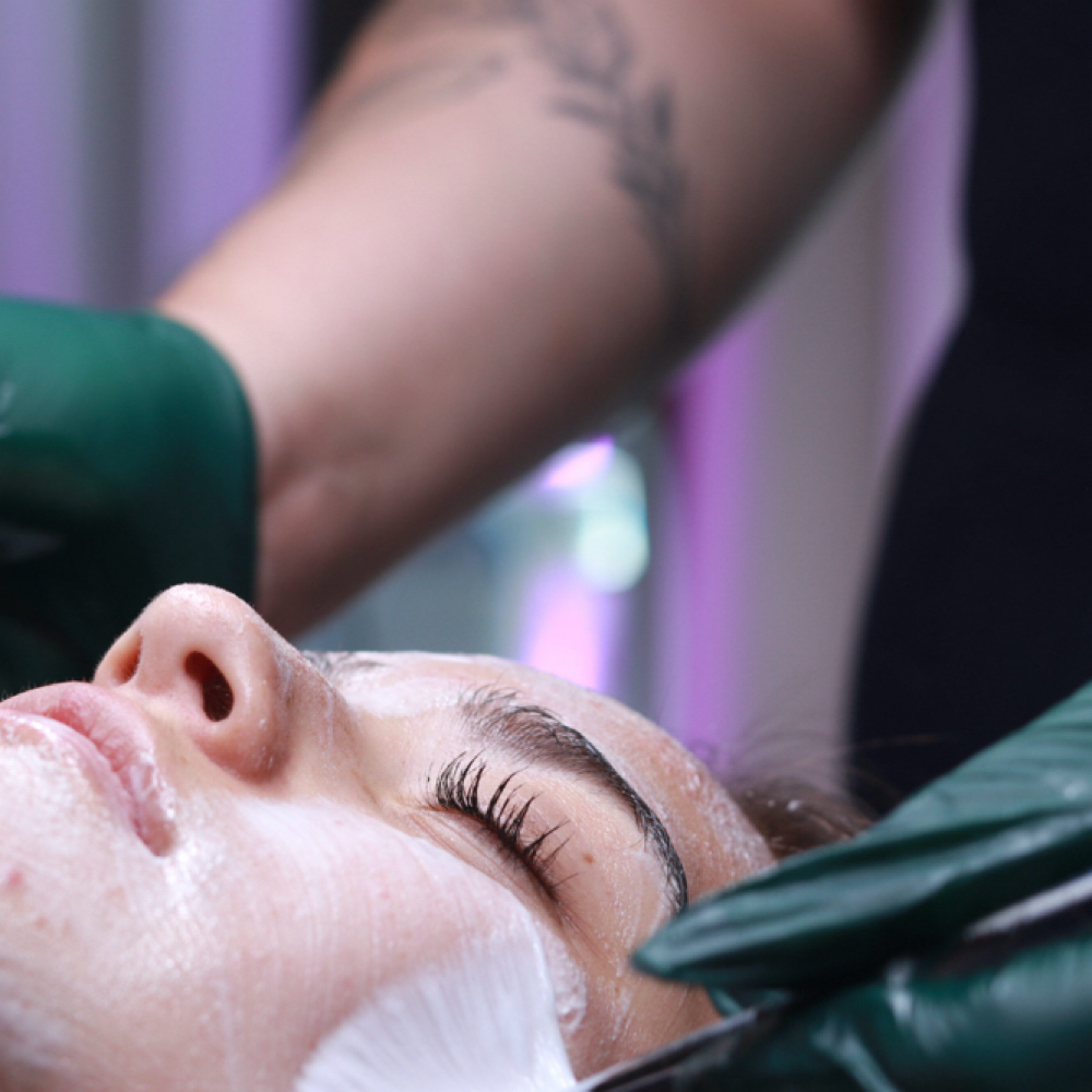 Microdermabrasion at Radiance Beauty in Kingsport, TN