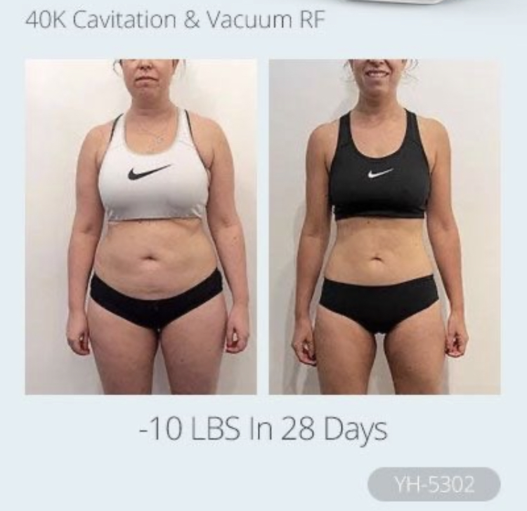 Body Contour