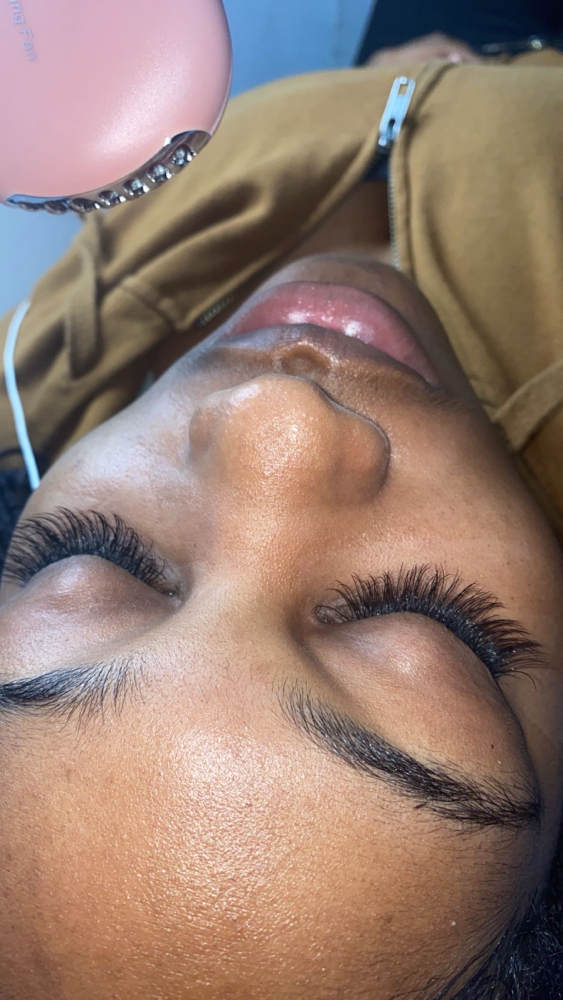 Hybrid Fill (2 Weeks) at Inalas_esthetique in Uniondale, NY