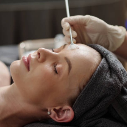 Signature Peel at Soluna Vee Spa in Colorado Springs, CO