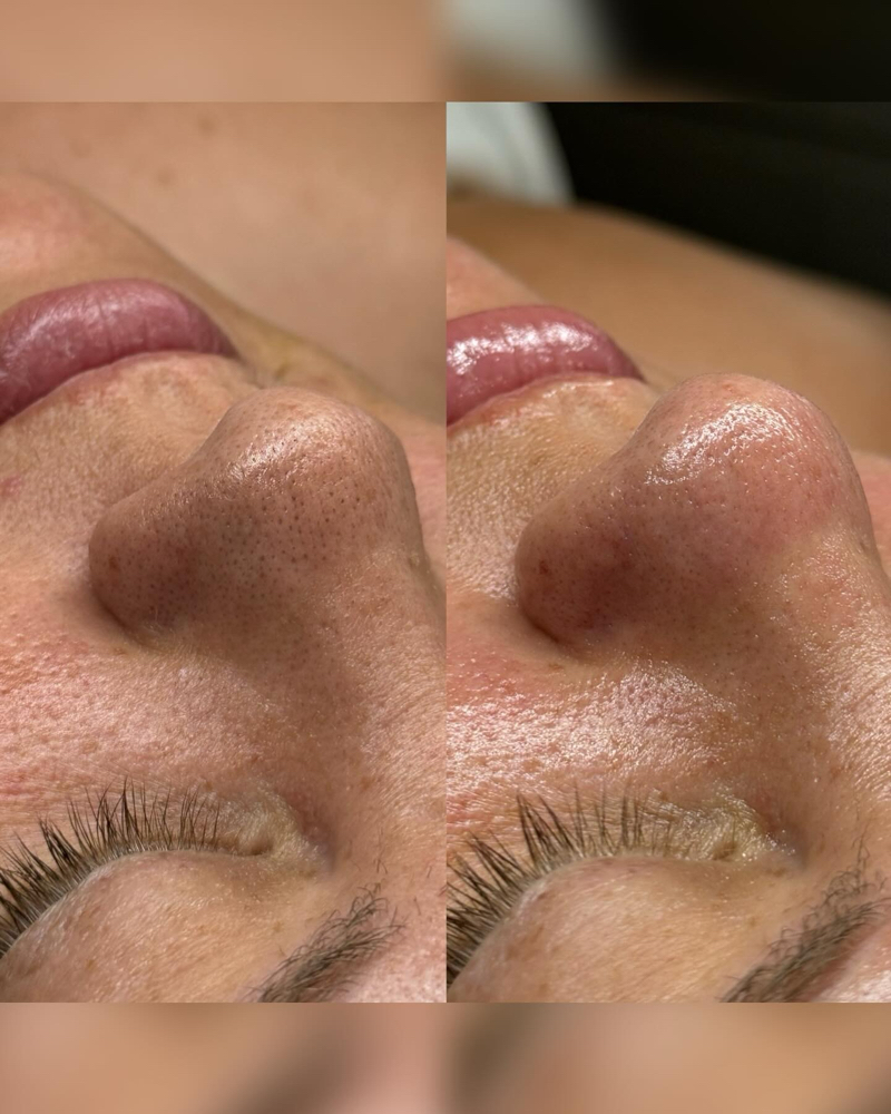 The Decongestion Facial