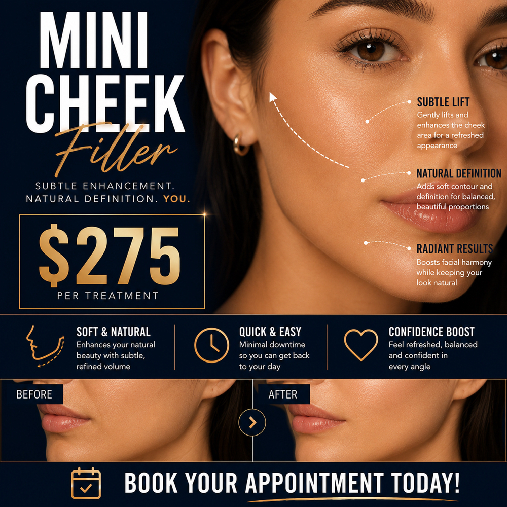 MINI CHEEK FILL at RGV PRIME AESTHETICS PLLC in Mcallen, TX