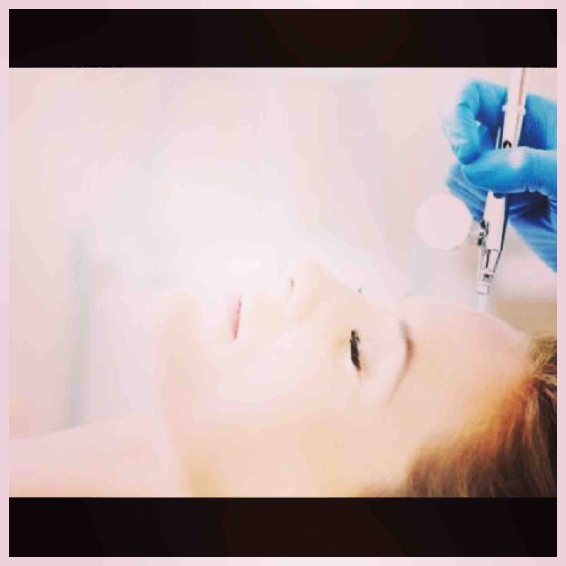 Oxigenacion Facial