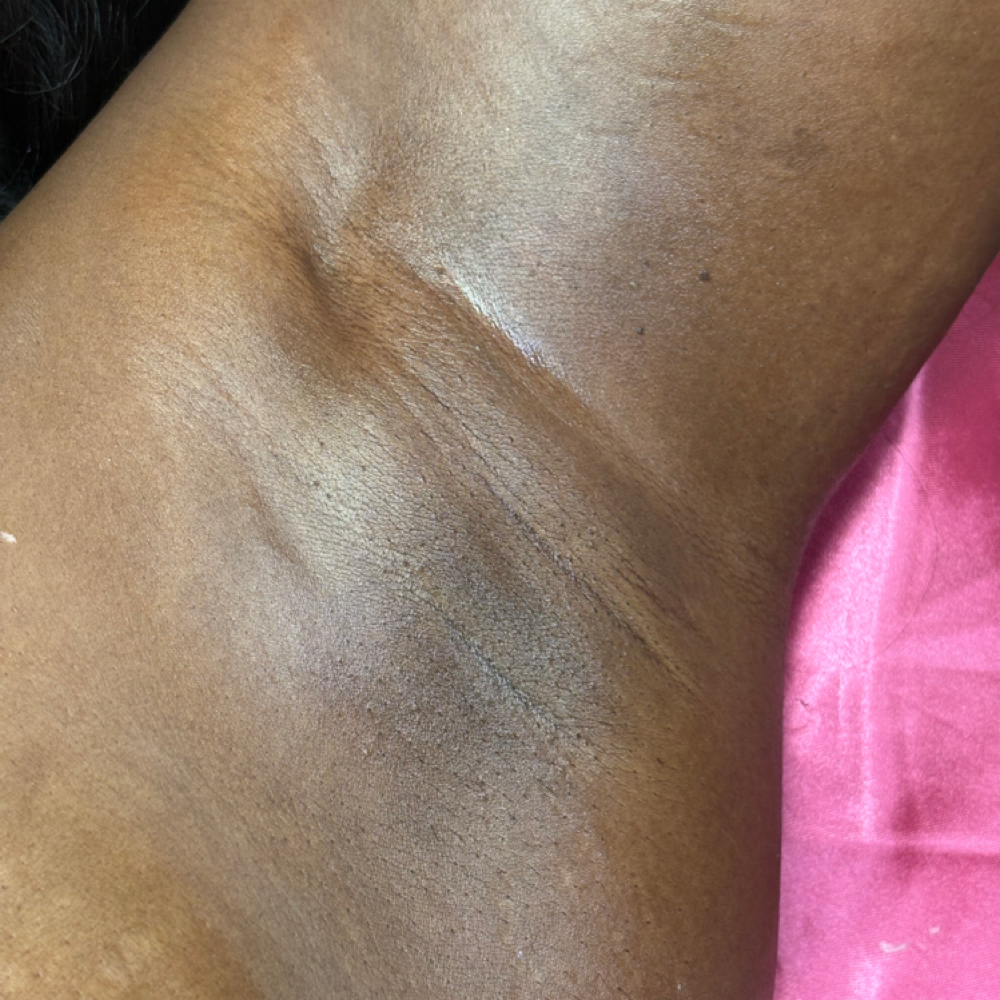 🍯 Underarm Waxing at The Facialholic Bar in Houston, TX