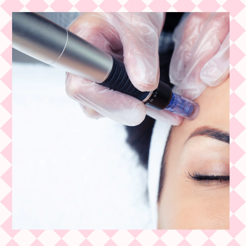 Microneedling