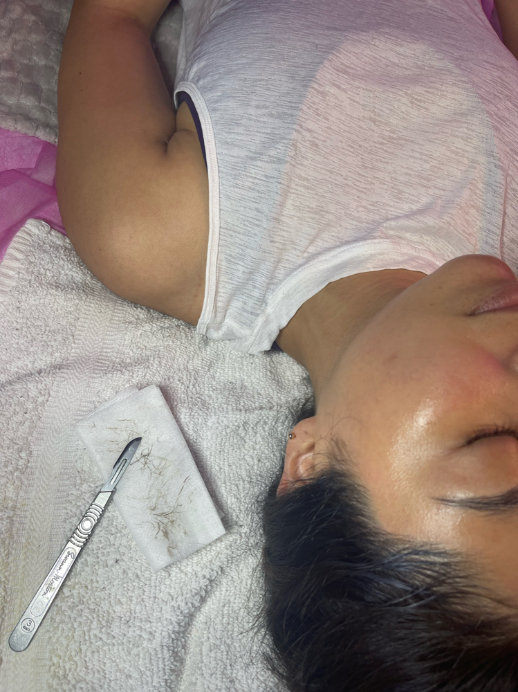 Dermaplane Facial