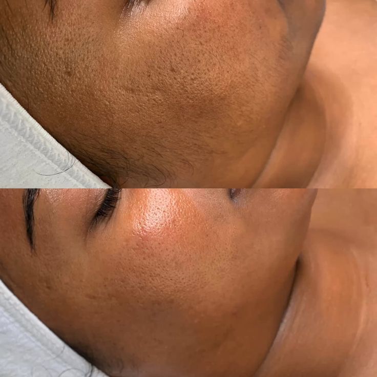 ULTIMATE SKIN RESET