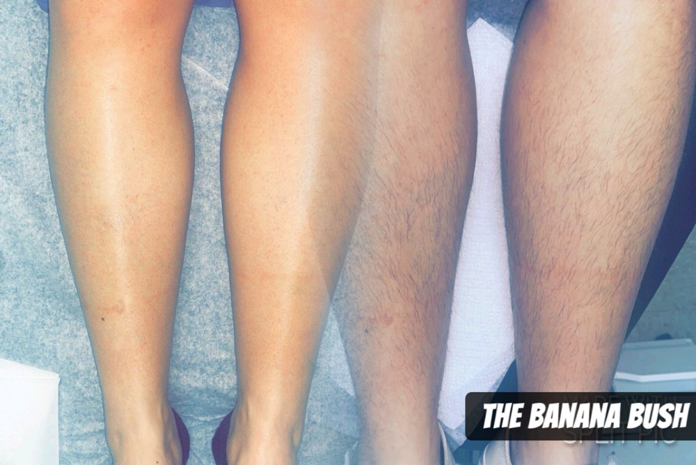 Waxing- Lower Leg