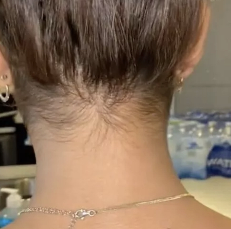 Hair Line