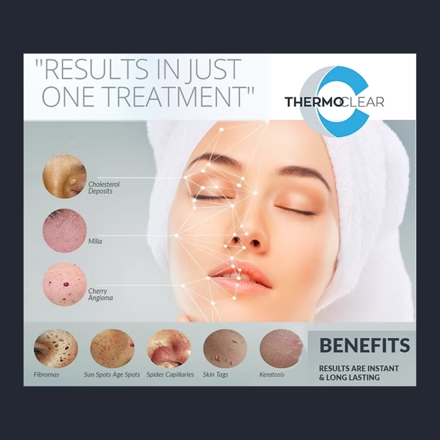 SKN Deep -Thermo Clear Treatment at SKN Deep by L&L in Peoria, AZ