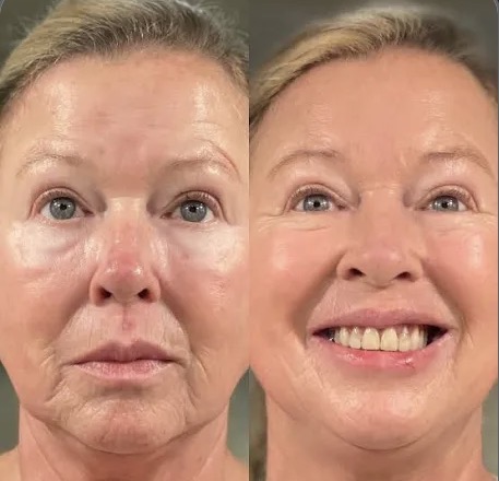Anti Aging Facial at THE BEAUTY SLANGER in Hacienda Heights, CA