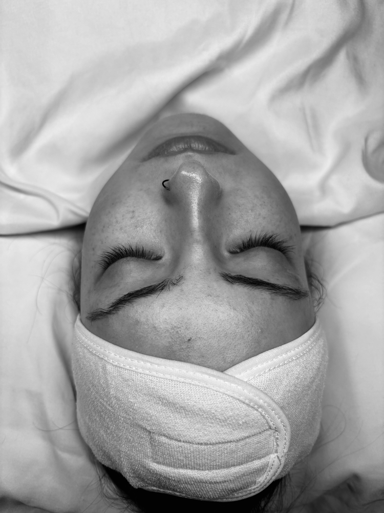 Skin Analysis Consultation