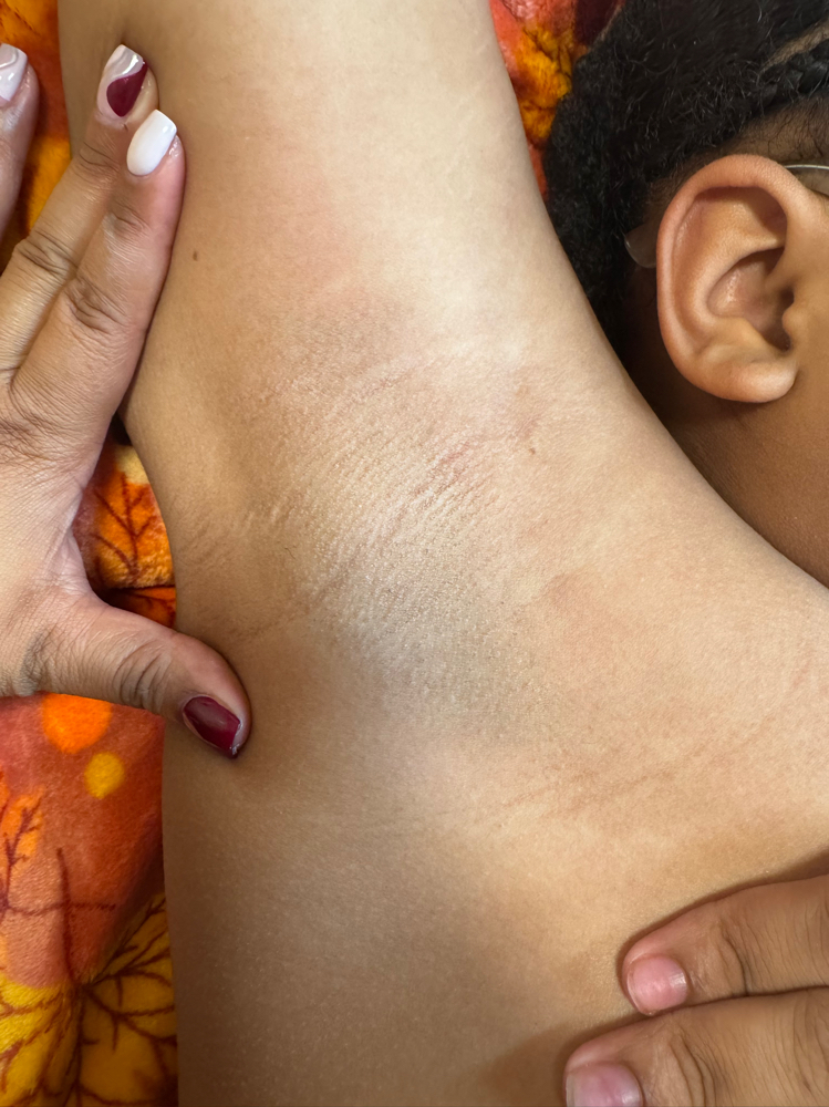 Underarms at Your Skin Haven in Brooklyn, NY