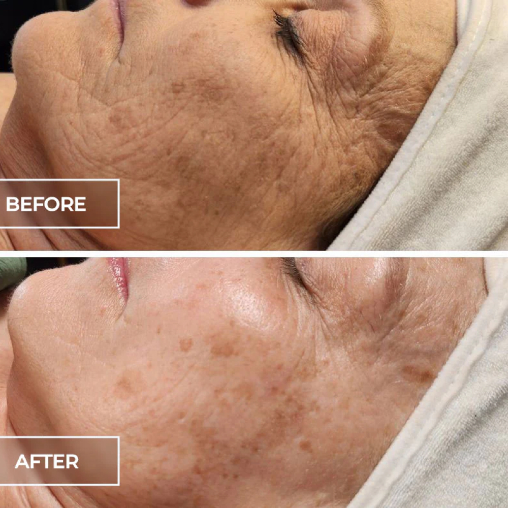 Circadia SWiCH Facial at Makarios Skin + Beauty Studio LLC in Bluefield, WV