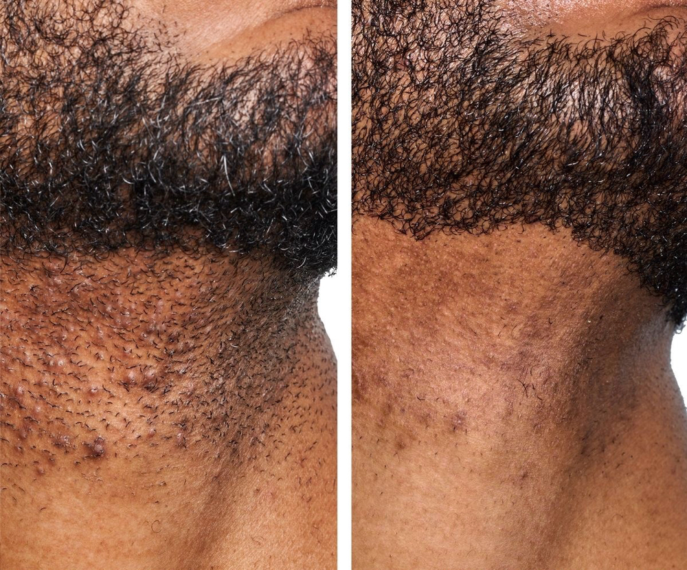 Gentleman’s Facial