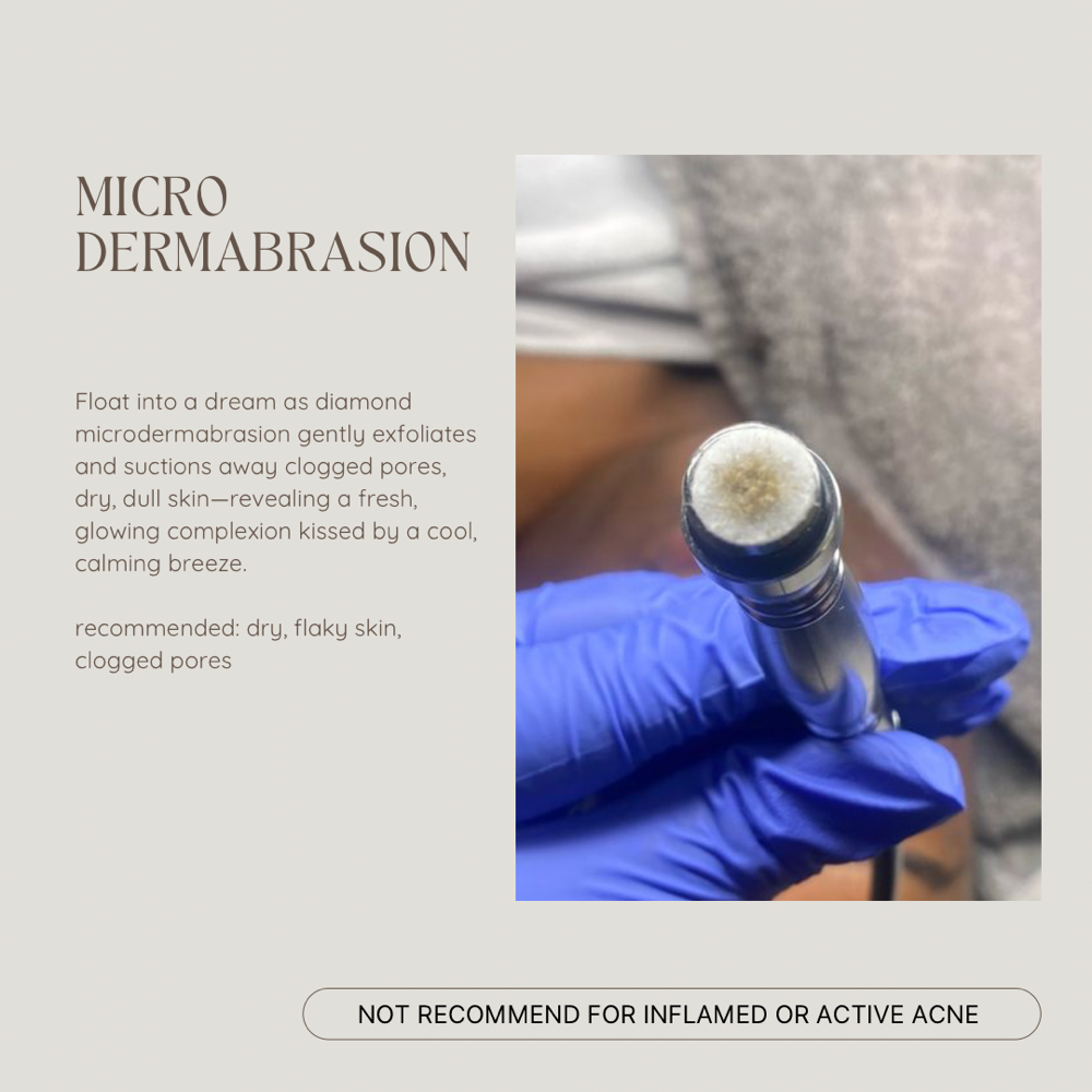 Microdermabration Facial at KKBEAUTE in Haines City, FL