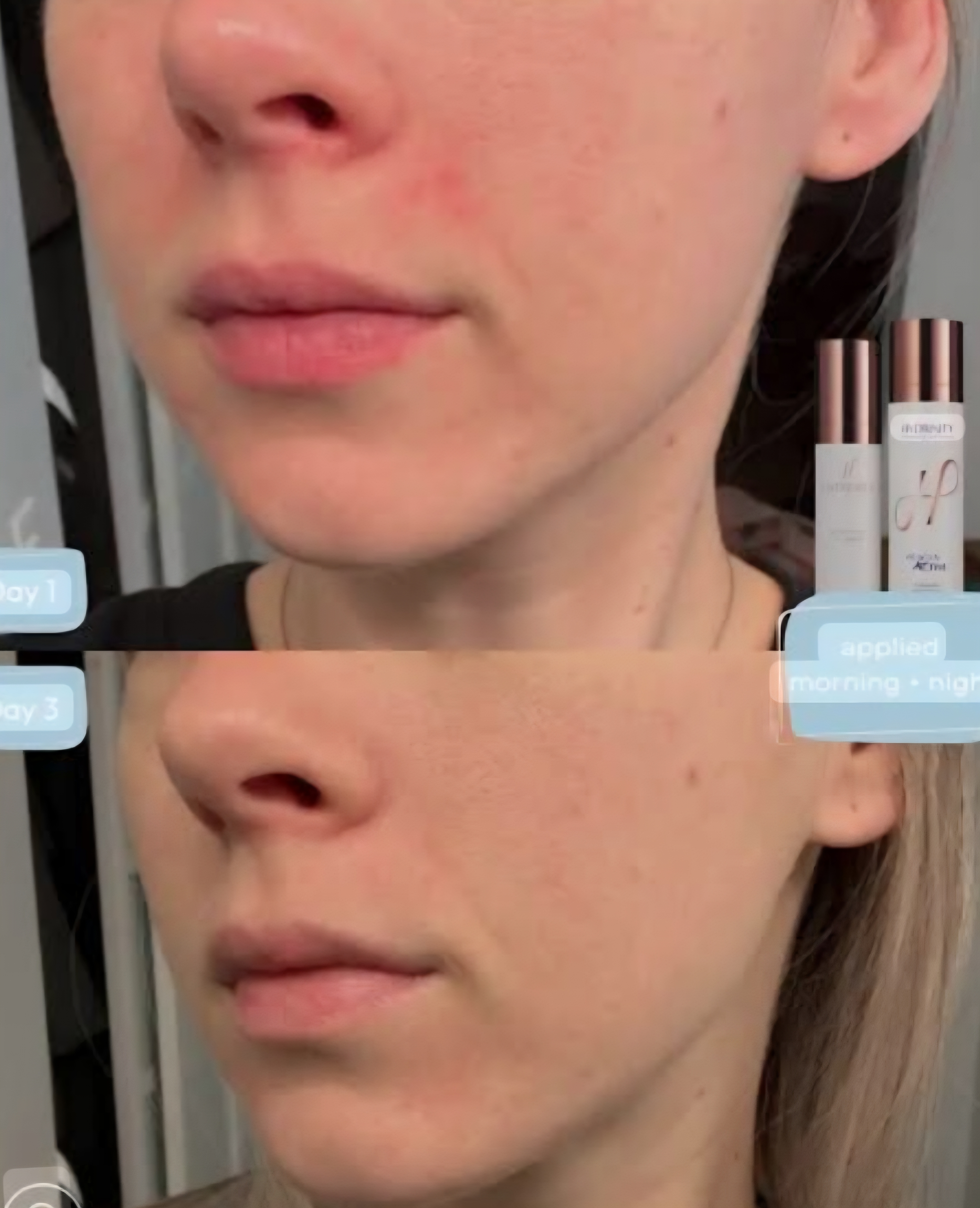 Clarifying Detox Facial