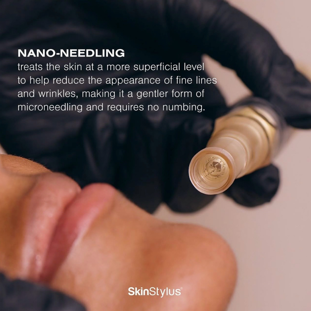 Nano-Needling Add-On at Milagro Beauty Bar in Plymouth, MI