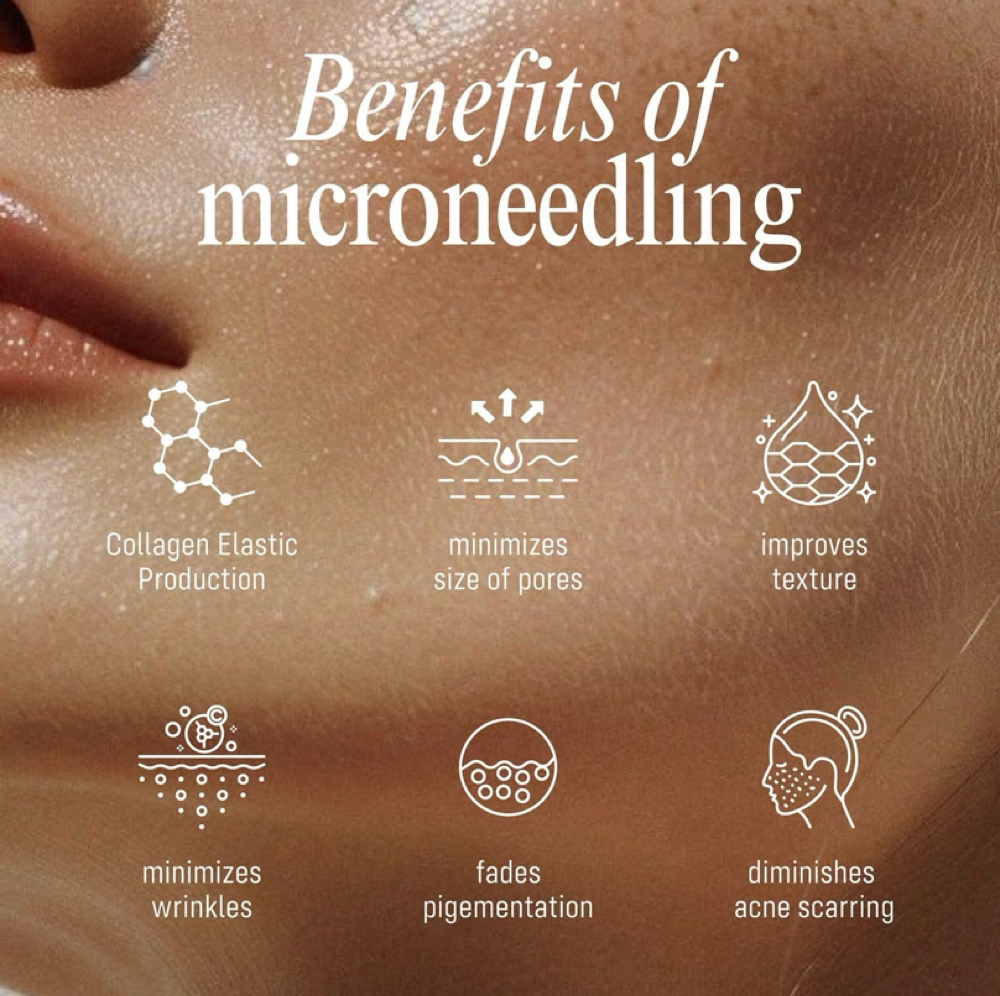Microneedling