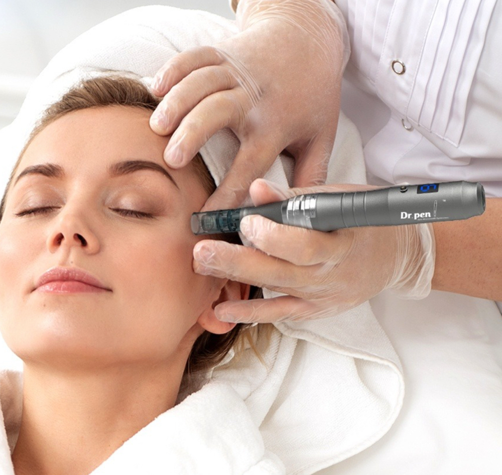 Microneedling With PRP