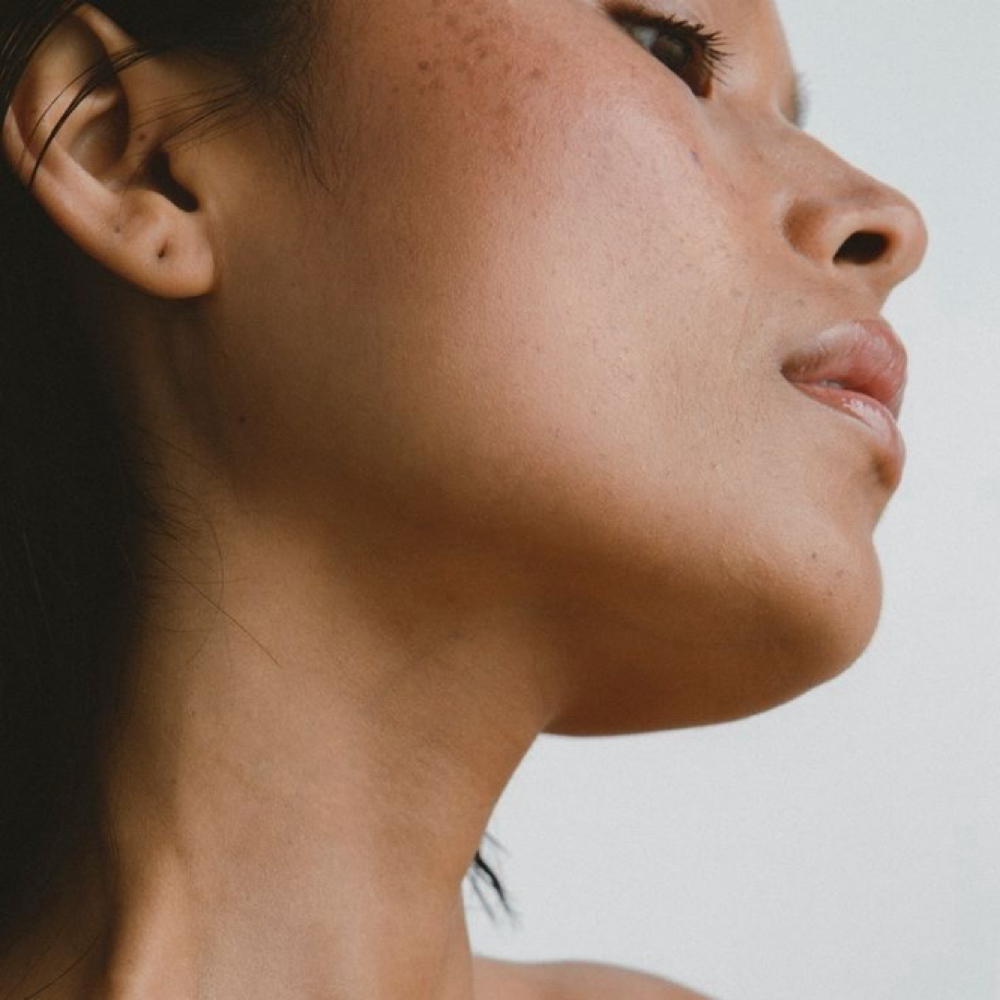 Chin at Andrew Gaines Aesthetics in Warner Robins, GA
