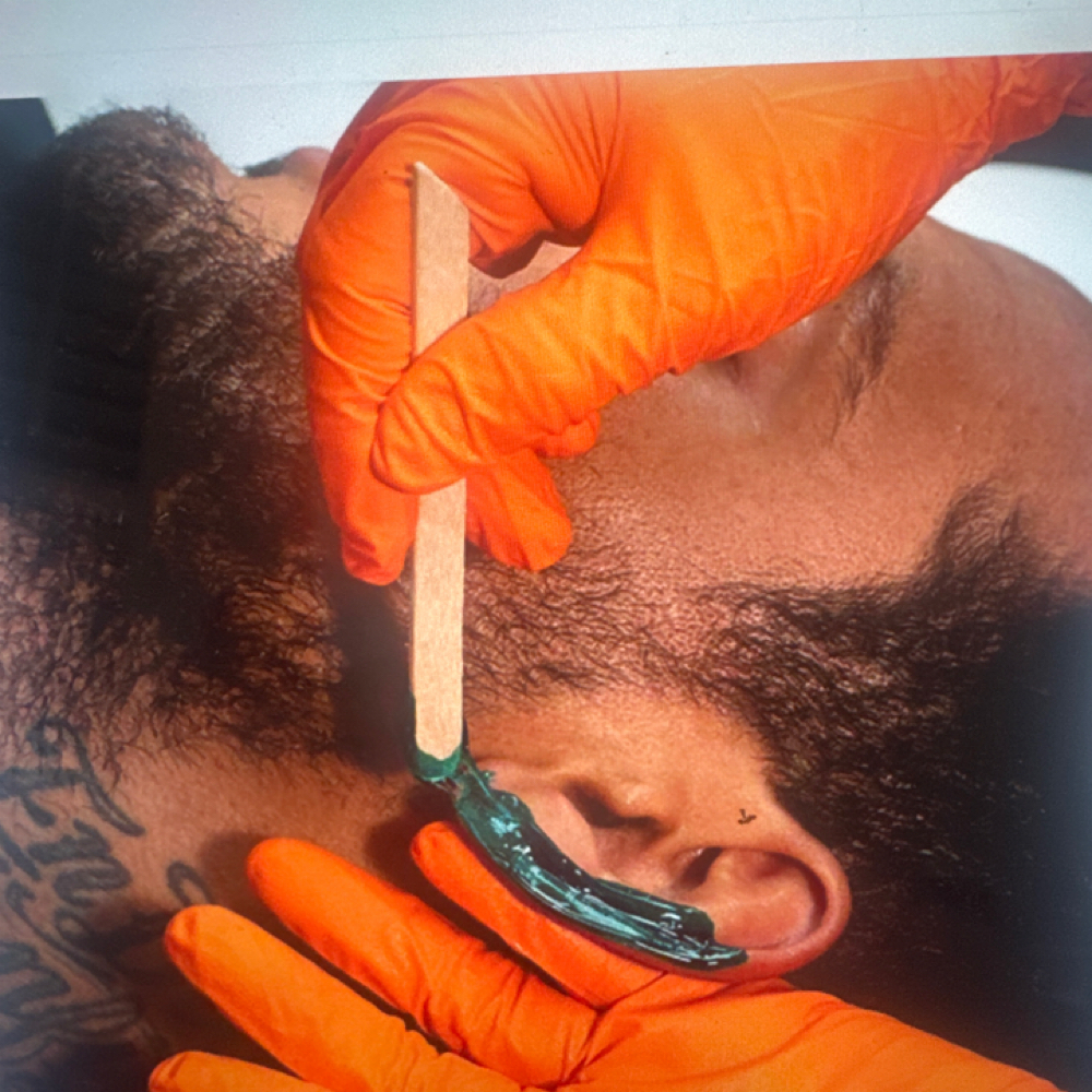 Ear Wax at MitzSkin Beauty in Buckeye, AZ