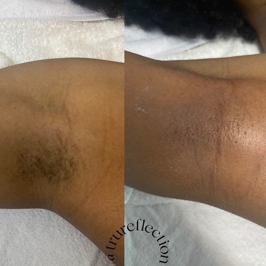 Under Arm
