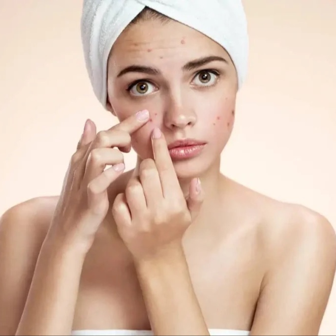 Acne Therapy Facial at Lush Skin Therapy in Mebane, NC