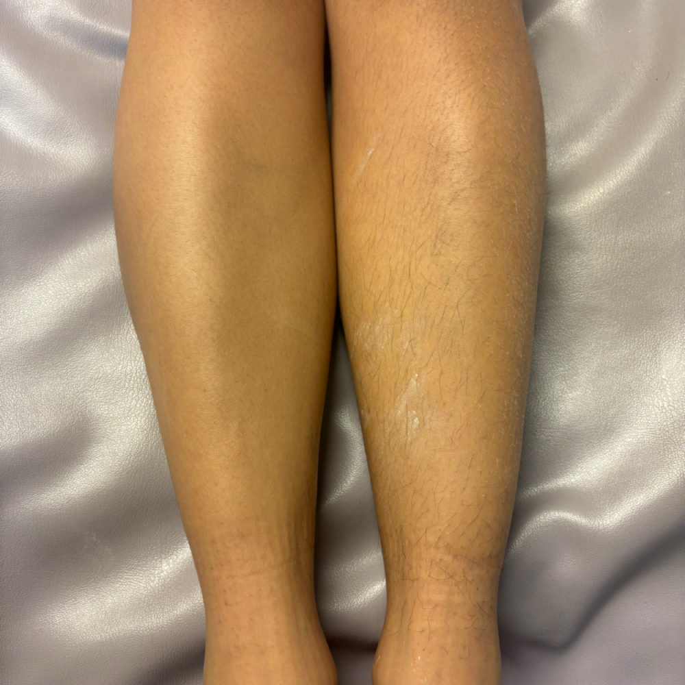 Leg & Arm Waxing at The Wax Palace in Buffalo, NY