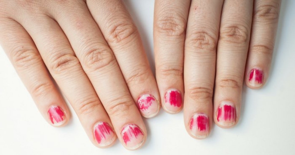 Nail Fix