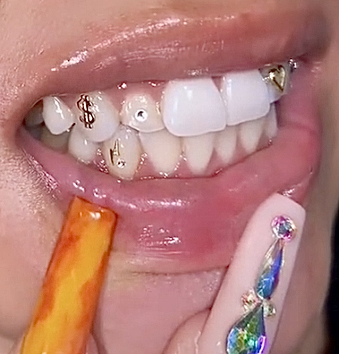 FLASH BOLT™ [BOTTOM LEFT]